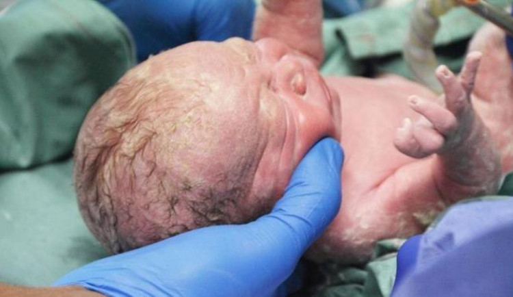 Po třech měsících v komatu porodila žena z Vysočiny zdravé dítě. Neprobralo ji to