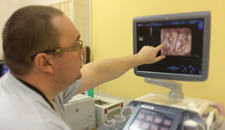 Z gynekologie jihlavské nemocnice můžete nově odejít s diskem se 4D ultrazvukovými záběry