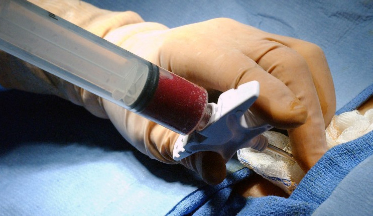 Bolí to? Taková je nejčastější otázka pro dárce kostní dřeně. Přijďte se zeptat  na besedu