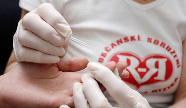 V pondělí proběhne v Jihlavě zdarma testování na virus HIV
