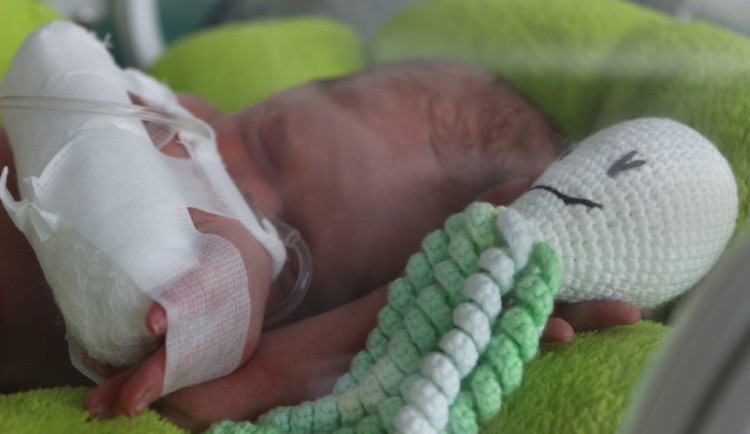 FOTO: Novorozencům v nemocnici pomáhají chobotničky. Díky nim lépe prospívají