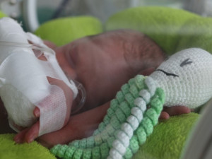 FOTO: Novorozencům v nemocnici pomáhají chobotničky. Díky nim lépe prospívají