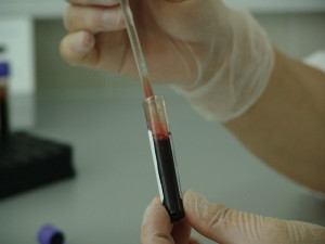 V Jihlavě se lidé mohou bezplatně nechat otestovat na HIV, syfilis nebo žloutenku