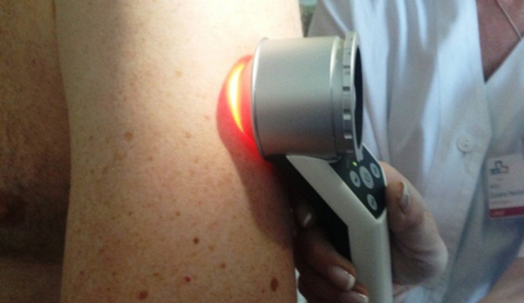 Na Den melanomu vyšetří v jihlavské nemocnici znaménka. Zájem lidí bývá velký