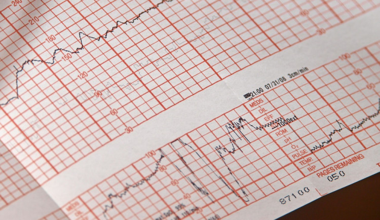 Jihlava má novou ambulanci pro profesionální sportovce. Využít ji může také široká veřejnost