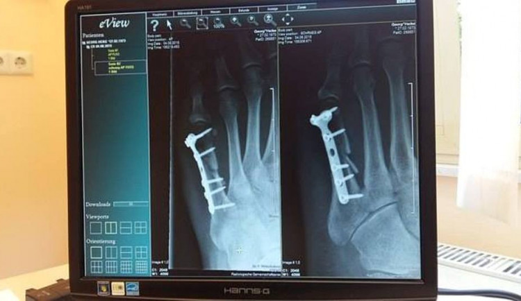 Novoměstská nemocnice má nový rentgen. Vyšel na více než šest milionů korun