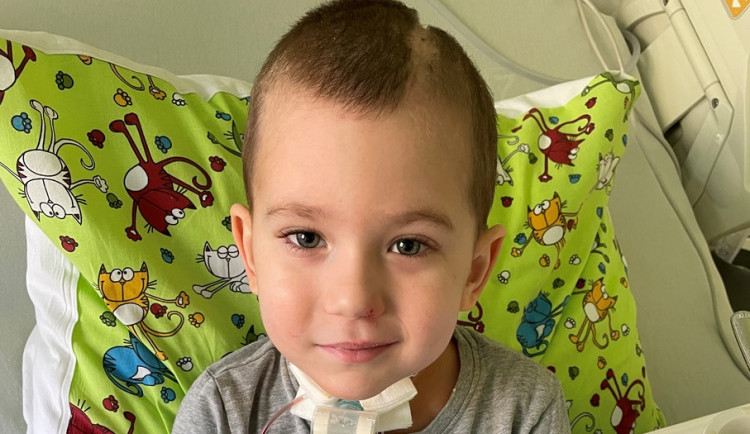 Malý Eddie prodělal bezpříznakový covid. Následkem bylo krvácení do mozku, k tomu obrna hlasivek 