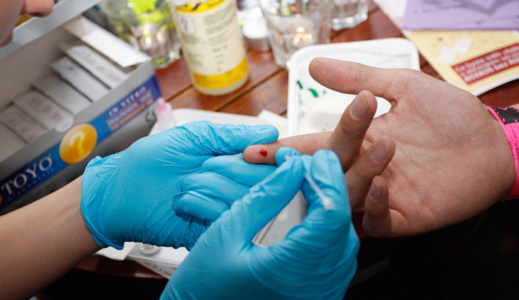 Zájemci v Jihlavě se mohou zdarma otestovat na HIV a žloutenku. Kdy a kam se případně vydat?