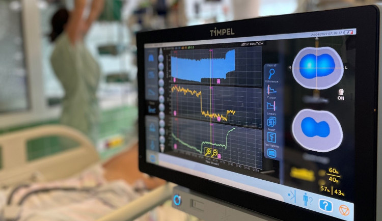 Plíce pacientů na ARO v Jihlavě sleduje nový přístroj. Stál téměř 2,5 milionu korun