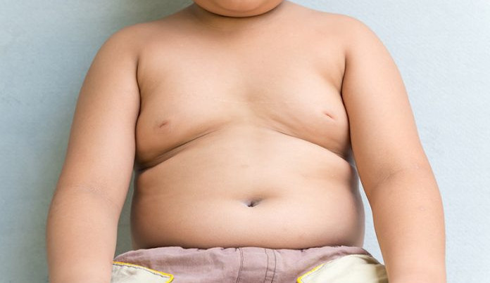 Rodiče si nepřipouštějí zdravotní následky nadváhy u dětí. Po upozornění raději změní pediatra