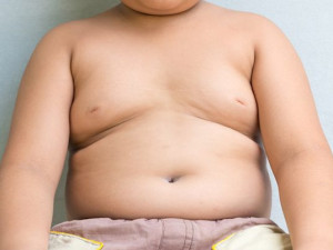 Rodiče si nepřipouštějí zdravotní následky nadváhy u dětí. Po upozornění raději změní pediatra