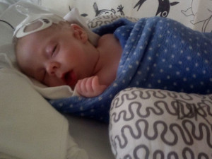 Dominik se narodil se třemi oušky a rozštěpem rtu, lékaři u něj objevili vzácné onemocnění