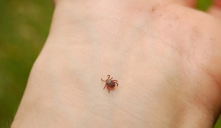 Mějte se na pozoru, Vysočina je teď plná klíšťat. Hygienici radí, jak správně postupovat při odstranění