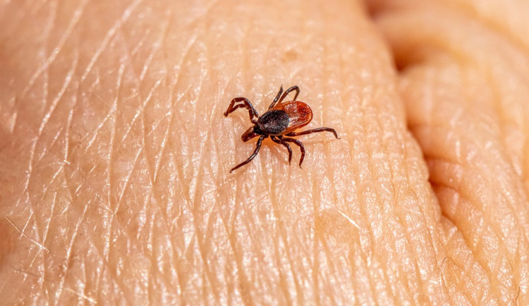 Obří nárůst klíšťové encefalitidy v Plzeňském kraji, loni bylo dvojnásob nákaz