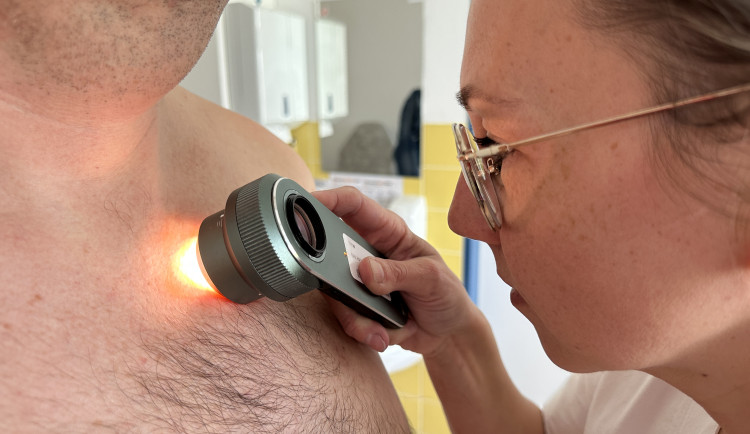 V třebíčské nemocnici kontrolovali kožní znaménka, odhalili zhoubné nádory. Foto: Se svolením Nemocnice Třebíč