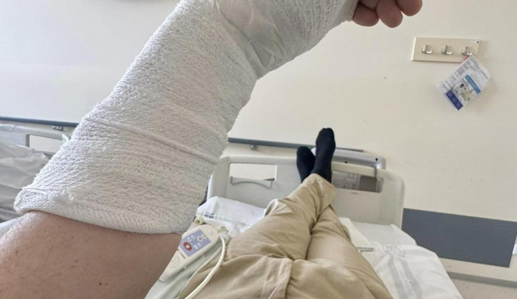 Hejtman Půta v nemocnici. Upadl na ulici a nadvakrát si zlomil ruku