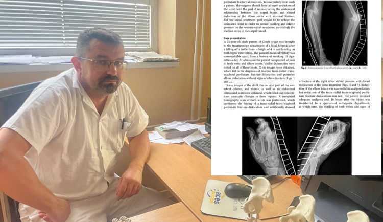 Primář Jaroslav Pilný a část jeho článku v prestižním časopise. Foto: Se svolením Nemocnice Nové Město na Moravě