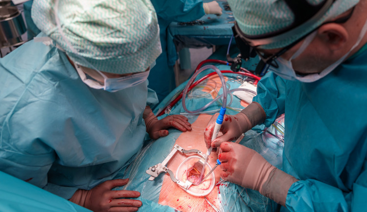 Šetrná výměna chlopně. Lékaři z Olomouce představili moderní operační metodu