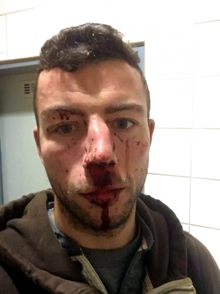 Michal Hlinka krátce po napadení v nemocnici