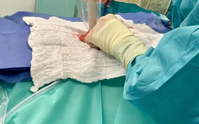 VIDEO: Lékaři v novoměstské nemocnici umí odhalit nádor prsu pomocí magnetického zrna. Jako první v kraji
