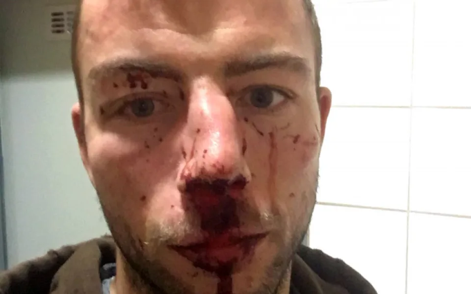 Michal Hlinka krátce po napadení v nemocnici